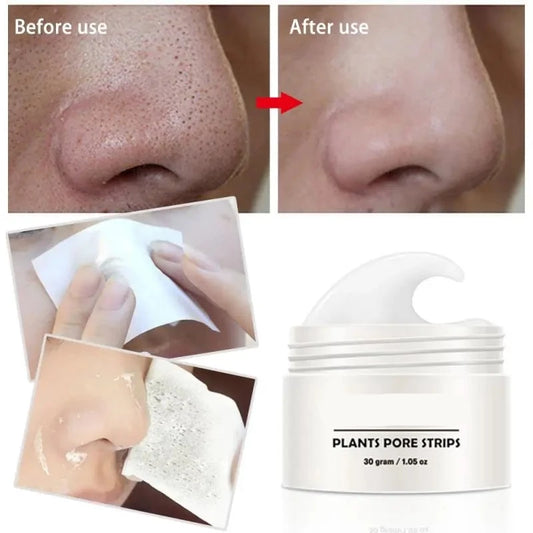 Blackhead Remover Cream